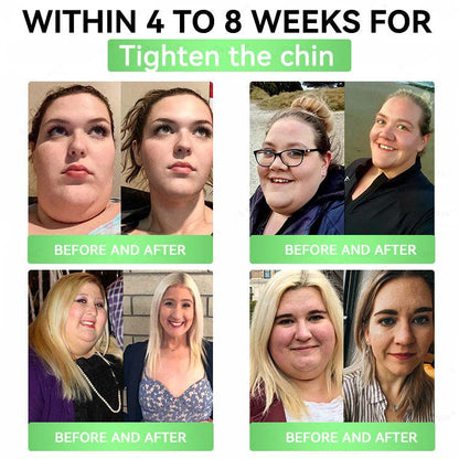 🔥Alcuras™ Moringa × Berberine × AMPK 8-Benefit Slimming & Metabolic Nano Microneedle Patch 🇺🇸 Just once a day · Visible changes in 7 days ✅ For obesity, loose skin, diabetes, sleep apnea, joint issues, and more
